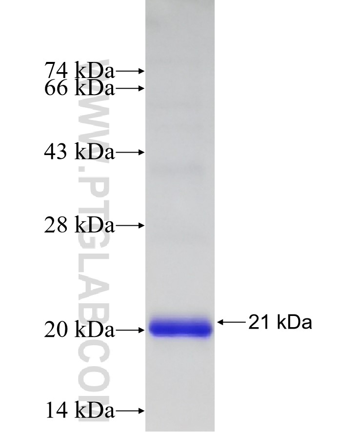 NODAL fusion protein Ag26736 SDS-PAGE