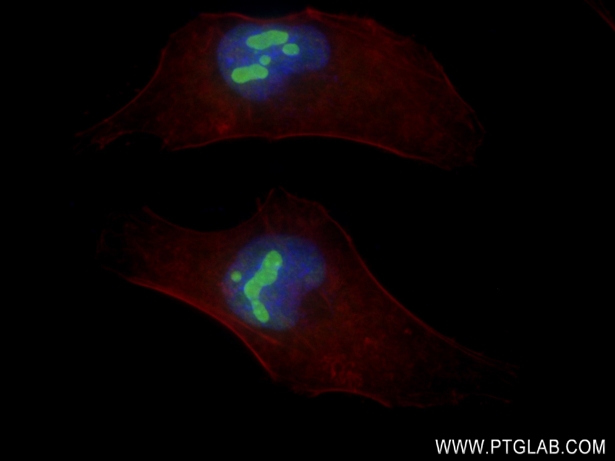 IF Staining of HeLa using 83391-6-RR