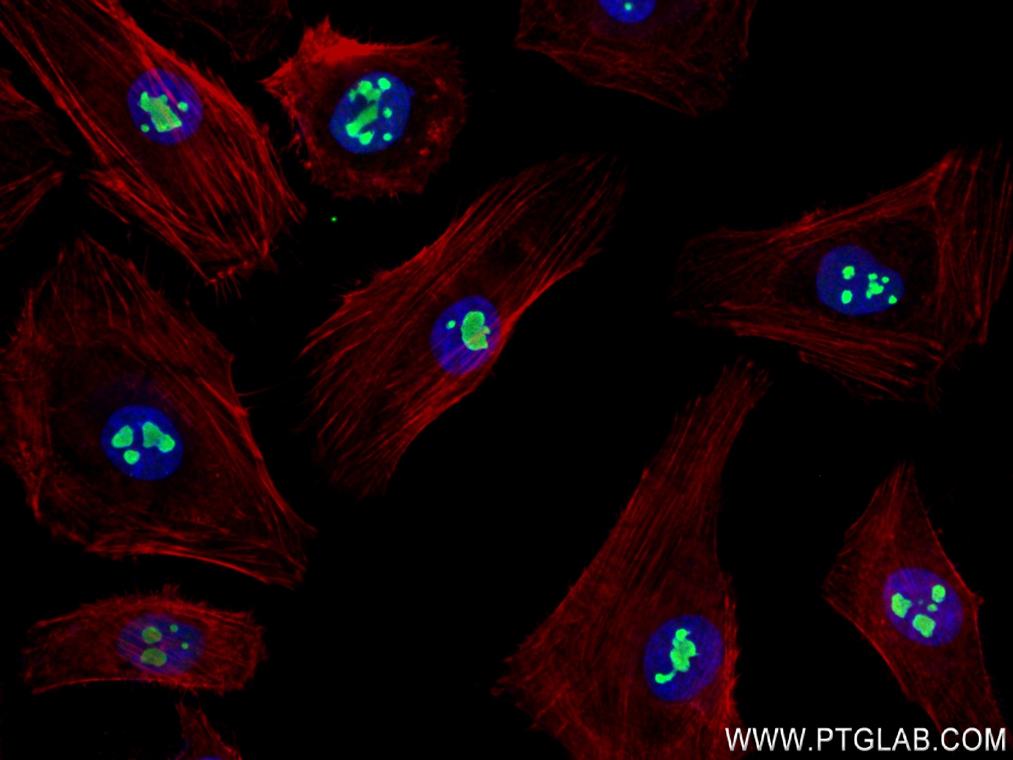 IF Staining of HeLa using 83391-6-RR