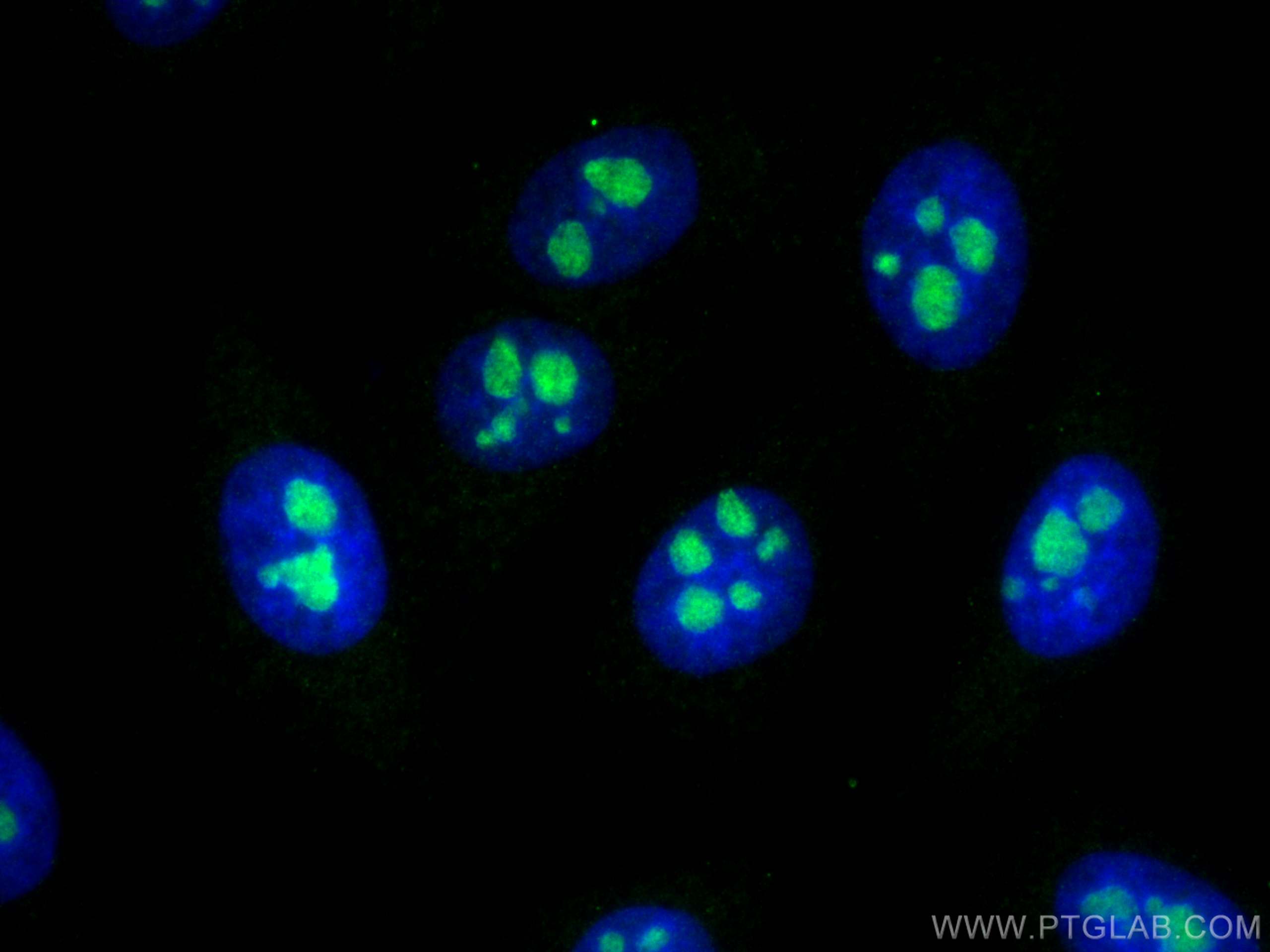 IF Staining of HepG2 using 15456-1-AP