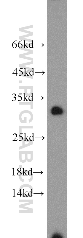 WB analysis of HeLa using 15456-1-AP