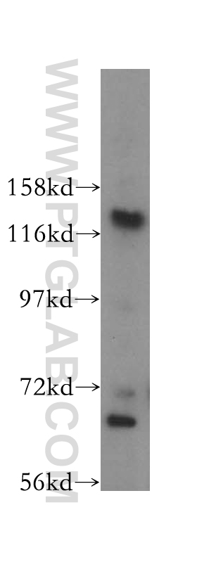 WB analysis of A431 using 16361-1-AP