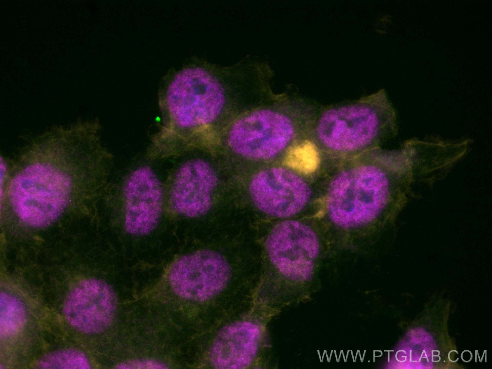 IF Staining of HCT 116 using 11058-1-AP