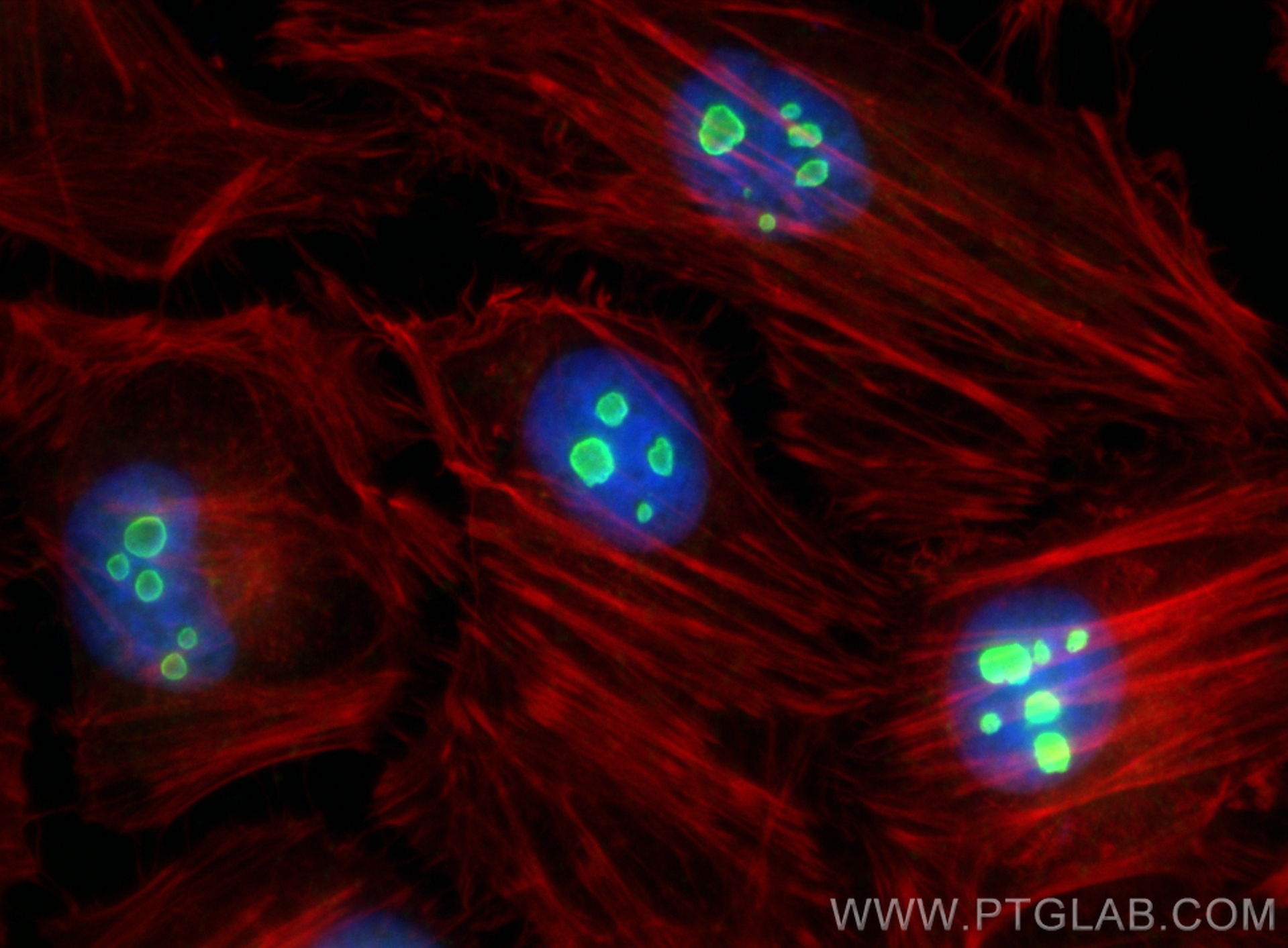 IF Staining of HeLa using 10448-1-AP