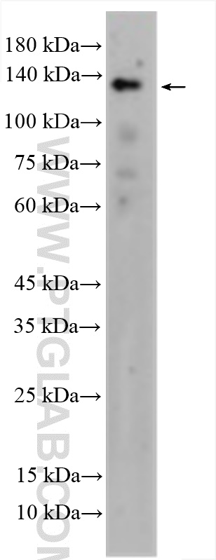 WB analysis of mouse liver using 27120-1-AP