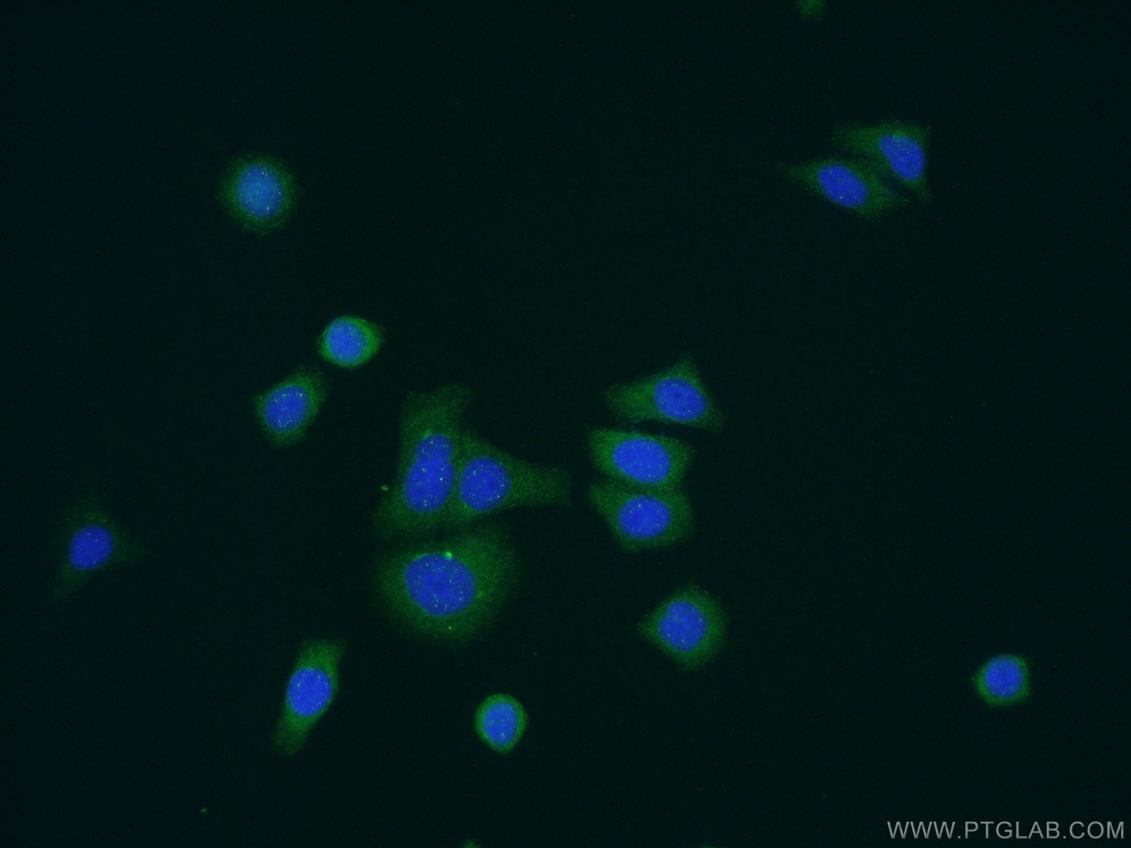 IF Staining of HepG2 using 20116-1-AP