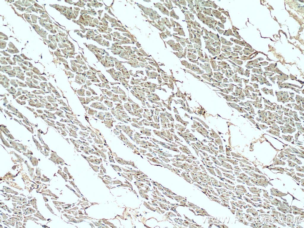 IHC staining of human heart using 20116-1-AP