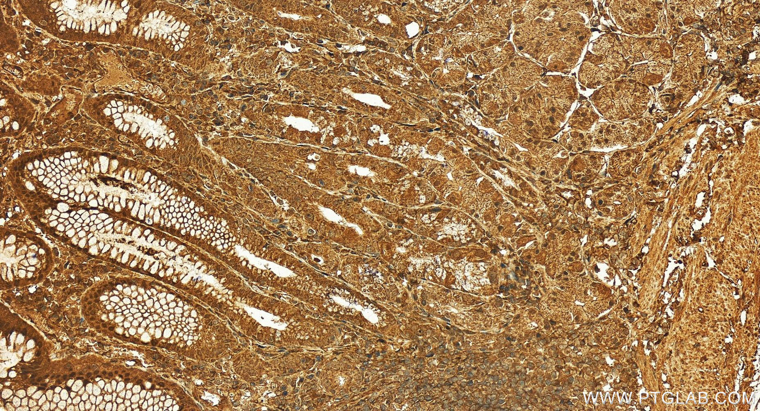 IHC staining of human stomach using 28580-1-AP