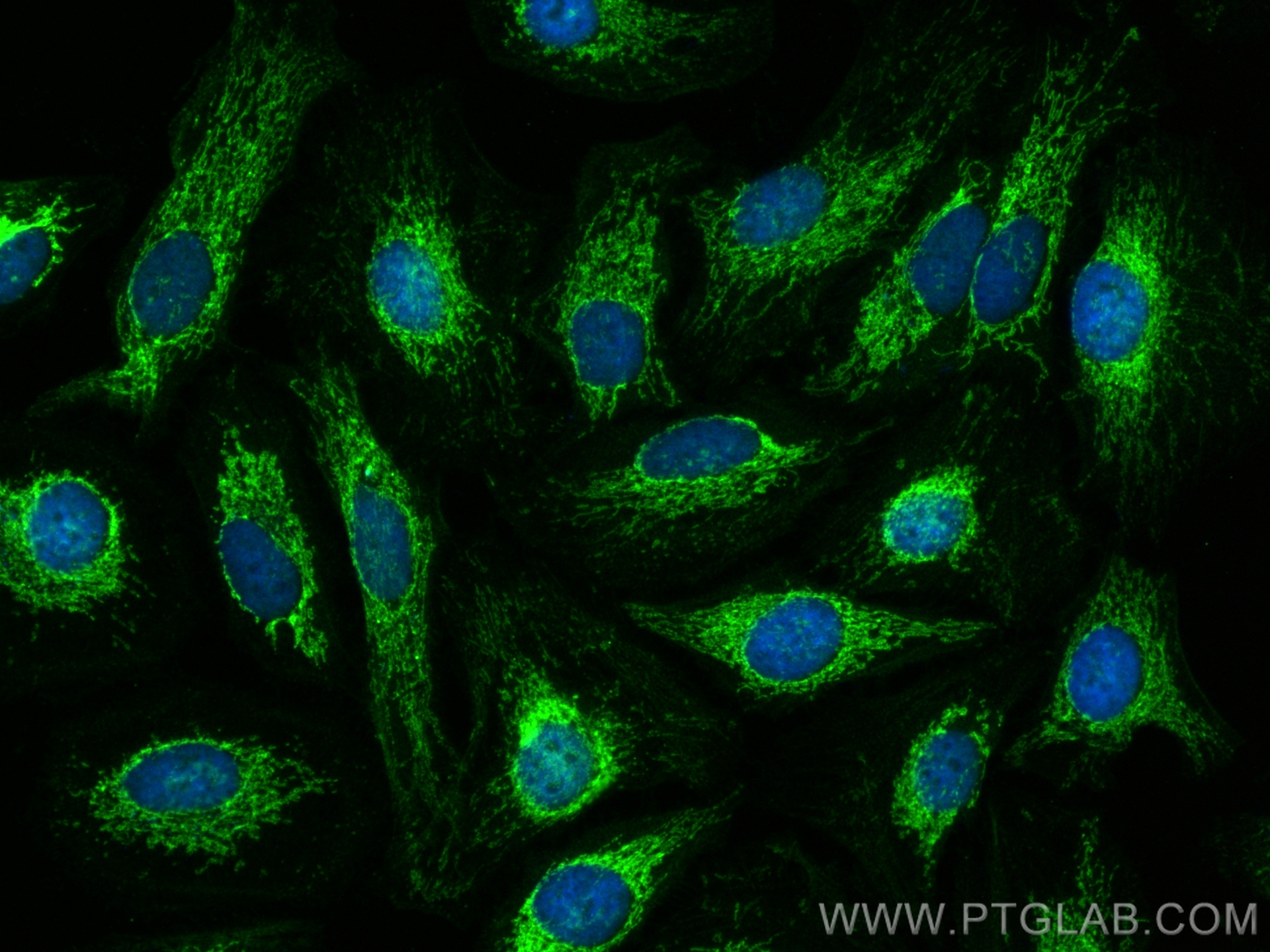 IF Staining of HeLa using 14347-1-AP