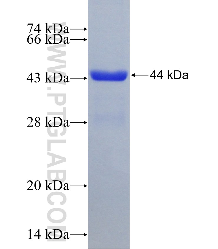 NOX5 fusion protein Ag18575 SDS-PAGE