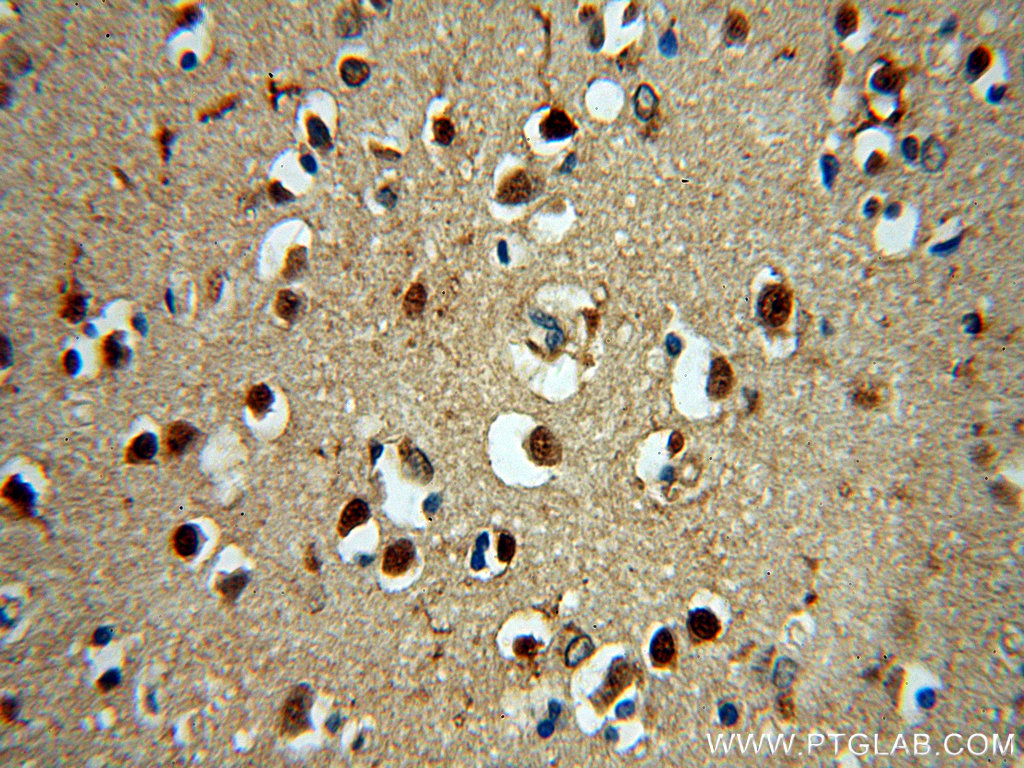 IHC staining of human brain using 13701-1-AP