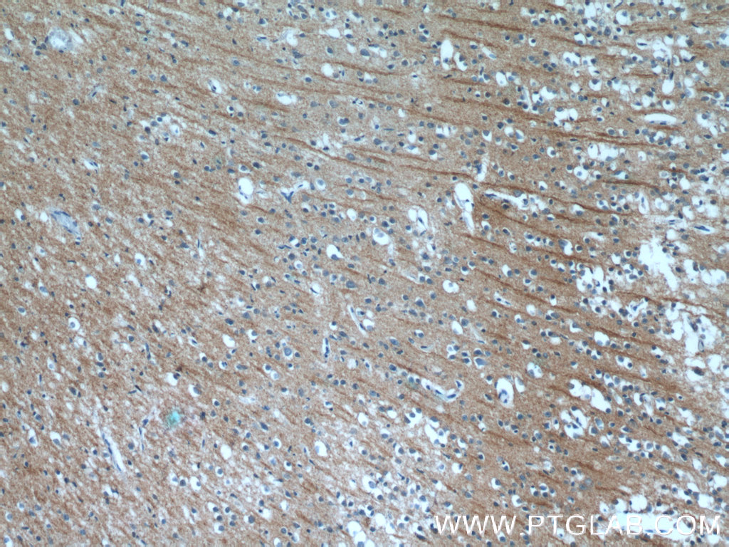 IHC staining of human brain using 25517-1-AP