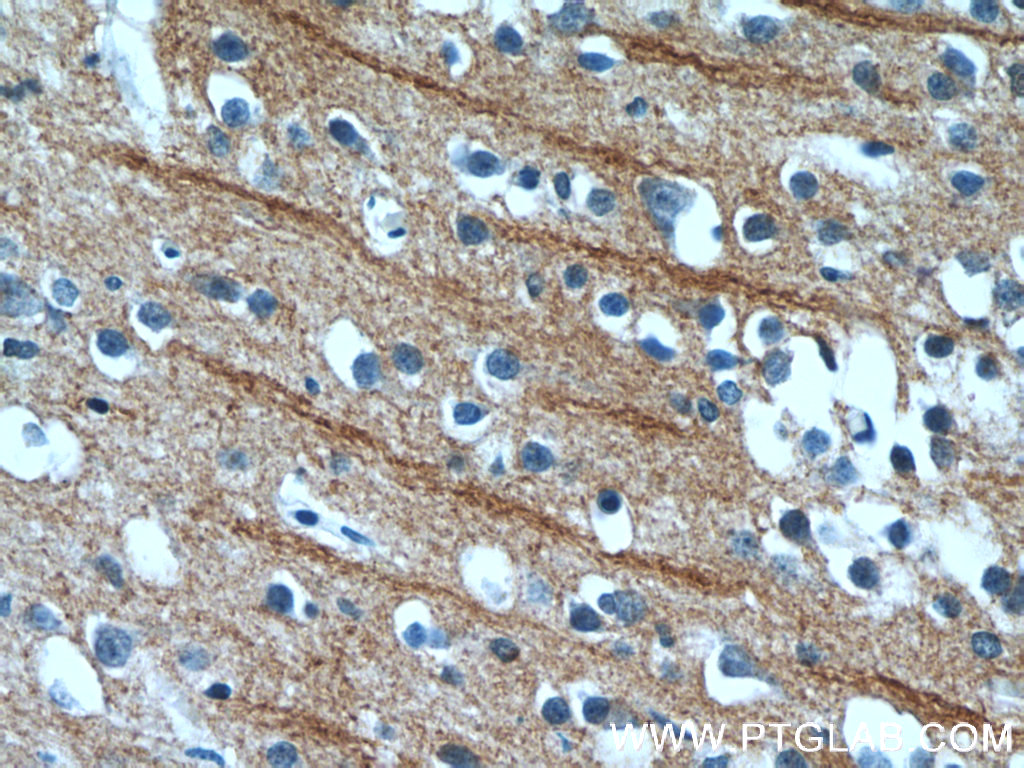 IHC staining of human brain using 25517-1-AP