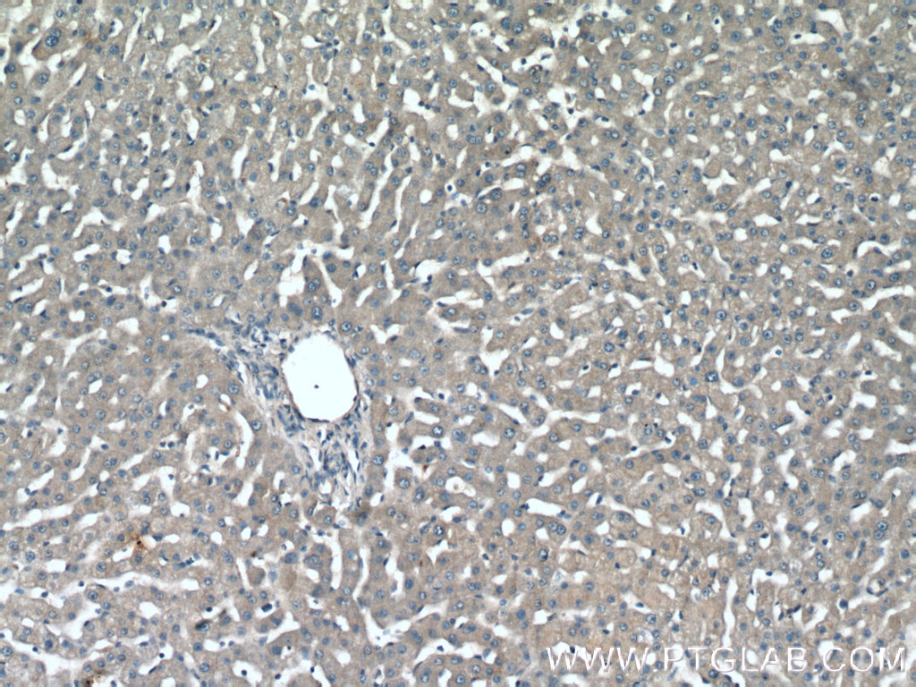 IHC staining of human liver using 19888-1-AP