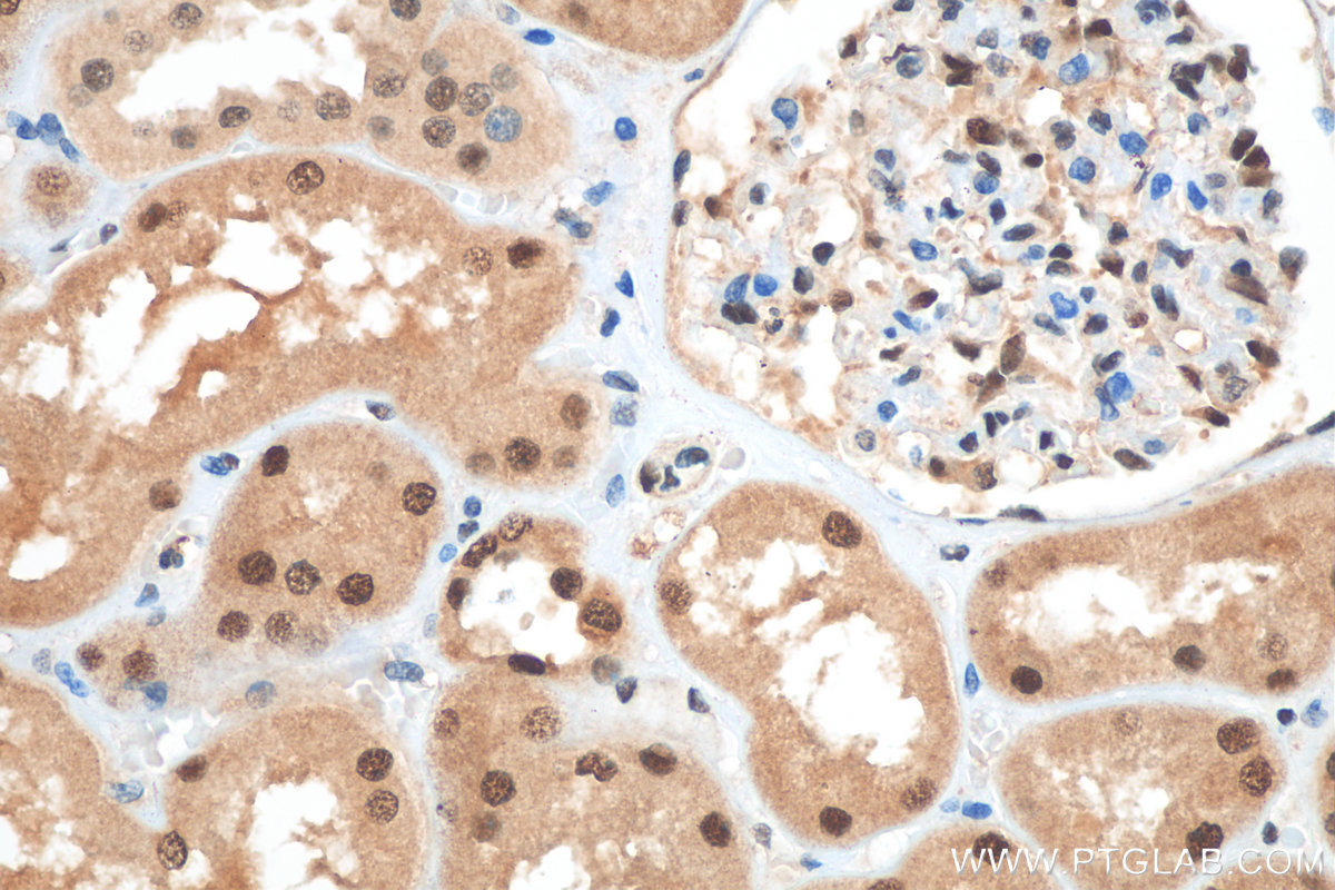 IHC staining of human kidney using 17211-1-AP