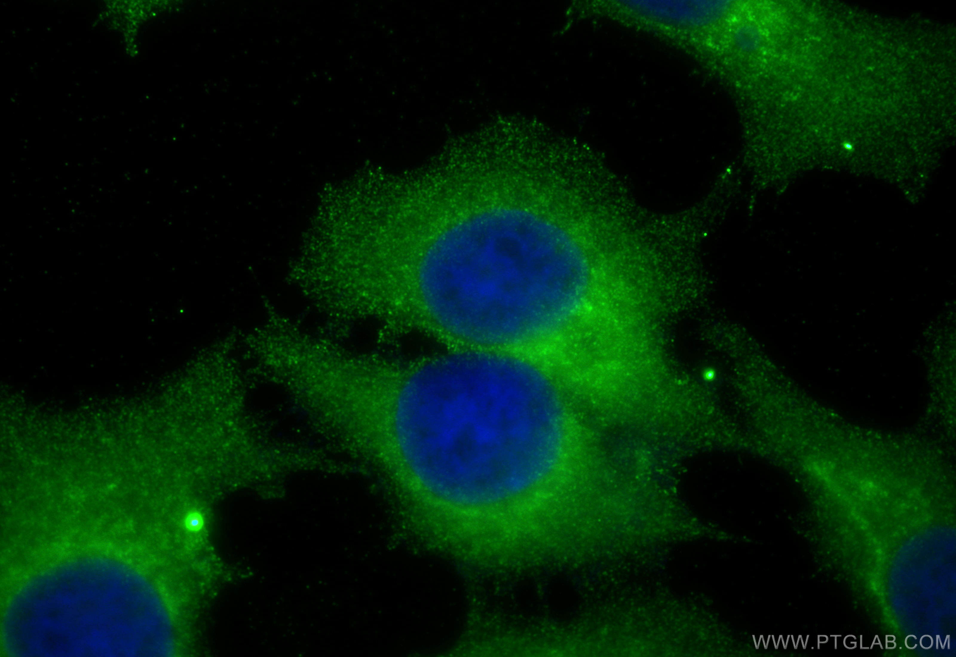 IF Staining of MCF-7 using 16715-1-AP