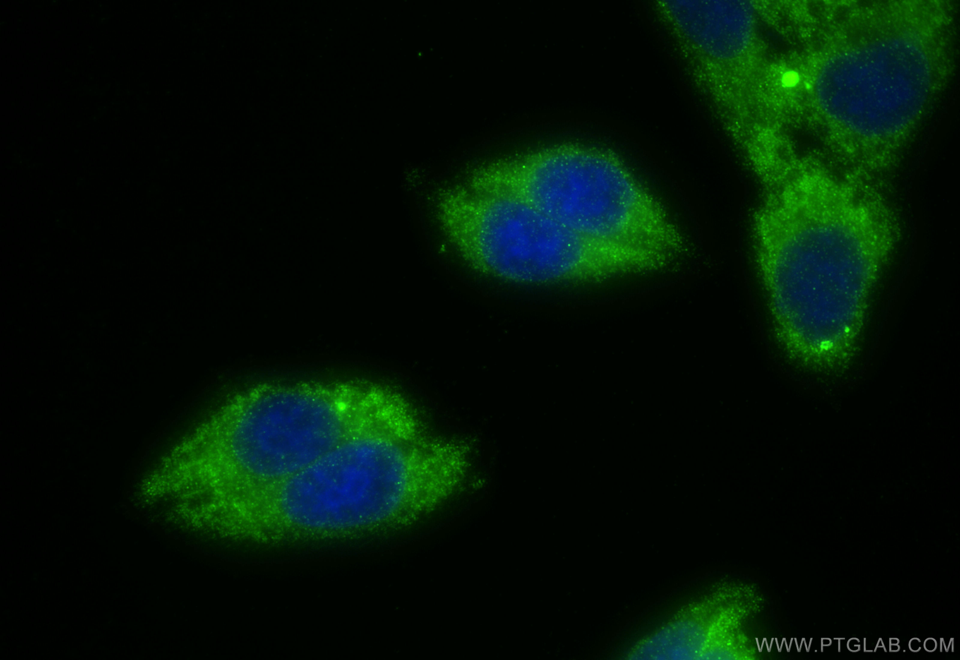 IF Staining of HepG2 using 13299-1-AP