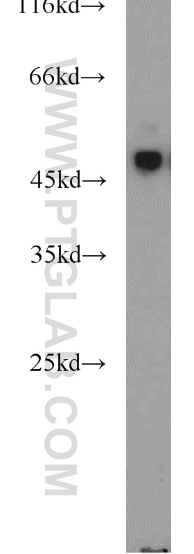 WB analysis of mouse pancreas using 10157-1-AP