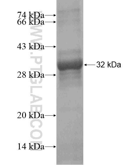 NPSR1 fusion protein Ag18785 SDS-PAGE