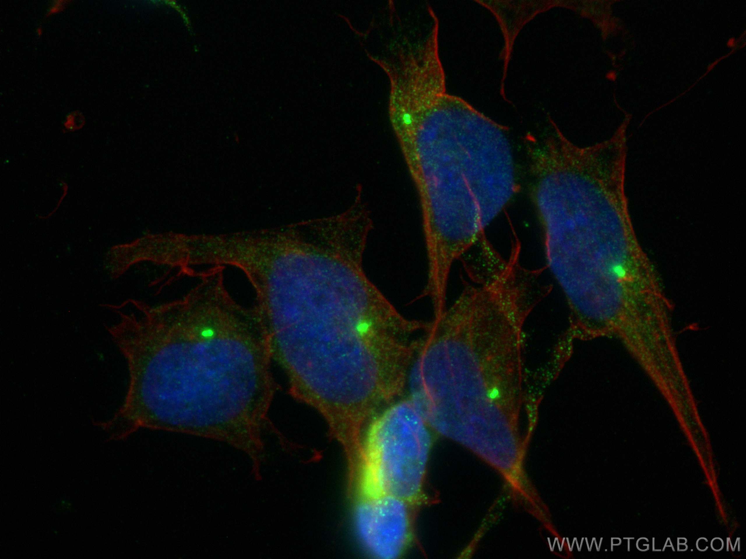 IF Staining of SH-SY5Y using 10889-1-AP