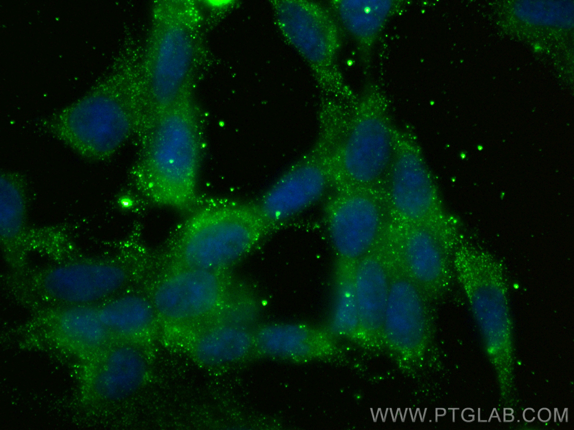 IF Staining of SH-SY5Y using 68709-1-Ig