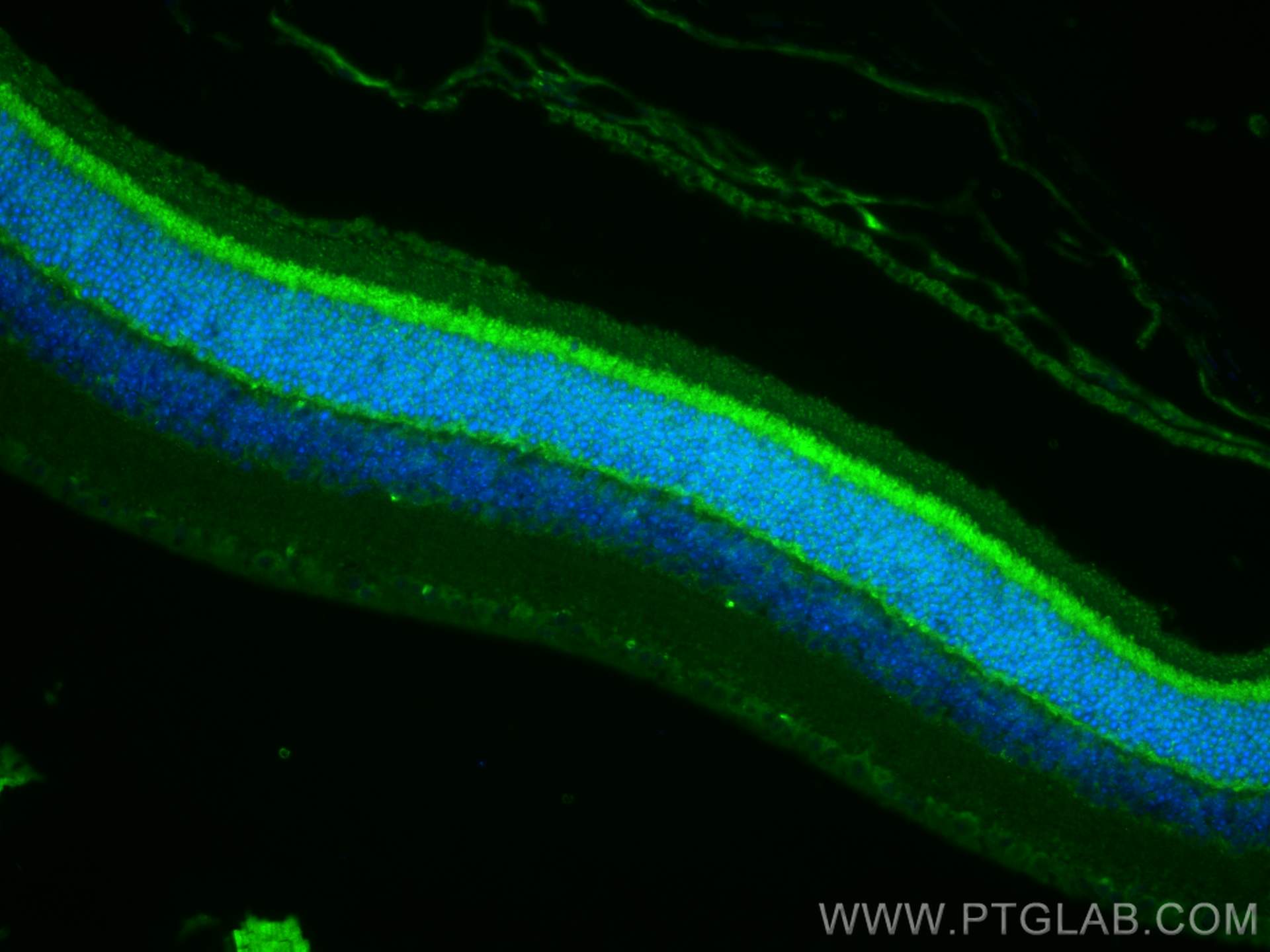 IF Staining of mouse eye using 12833-1-AP