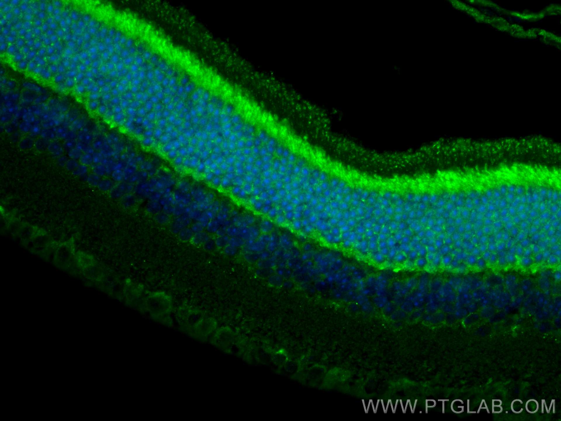 IF Staining of mouse eye using 12833-1-AP