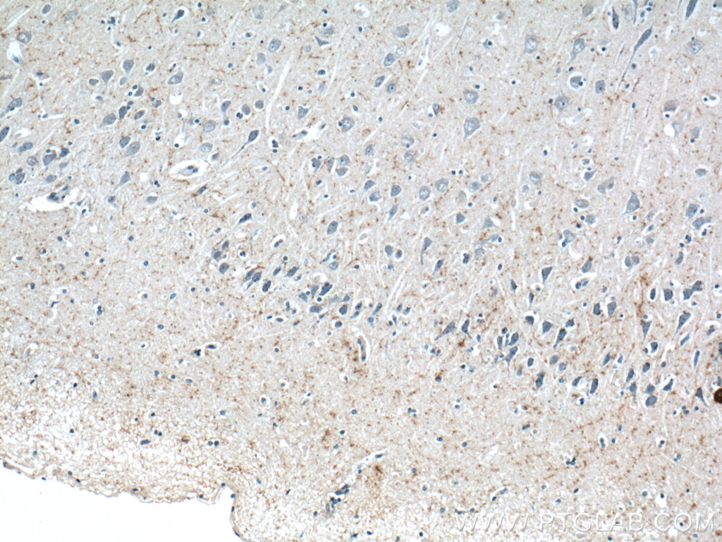 IHC staining of human brain using 12833-1-AP