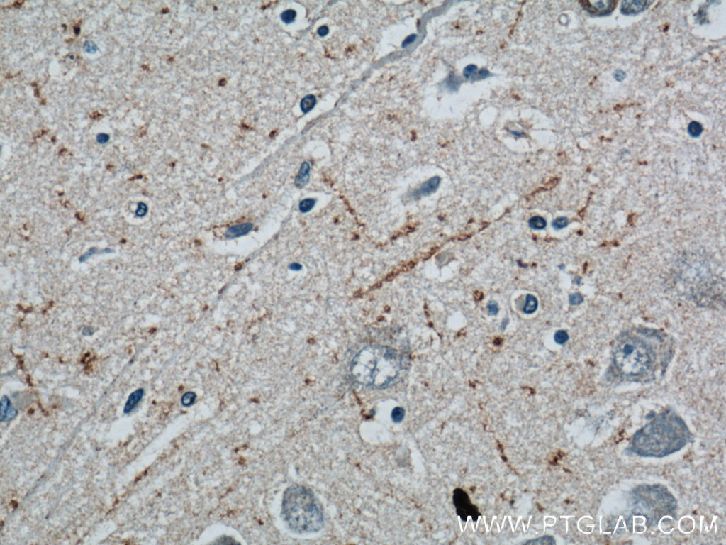 IHC staining of human brain using 12833-1-AP