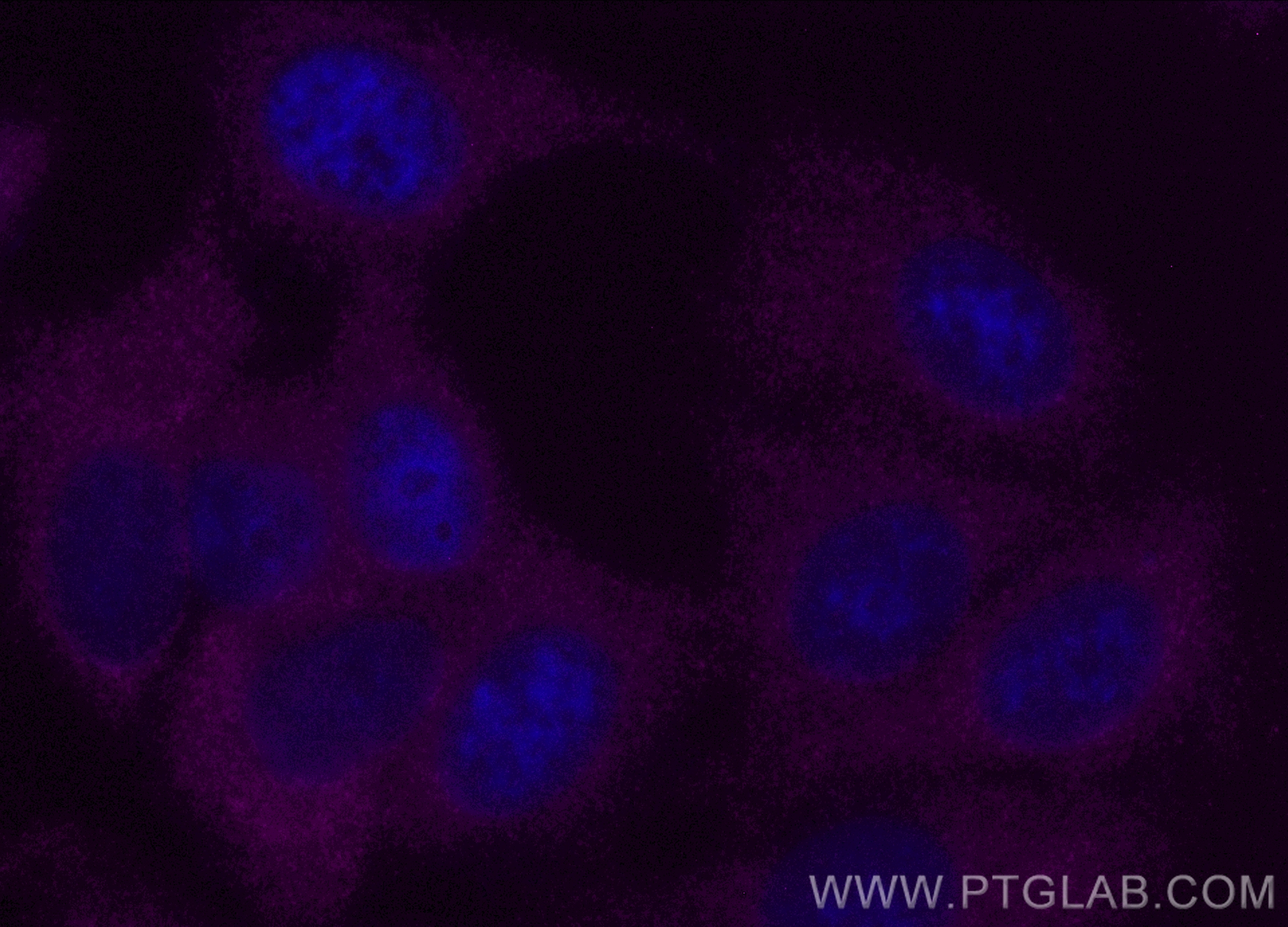 IF Staining of MCF-7 using CL647-11451