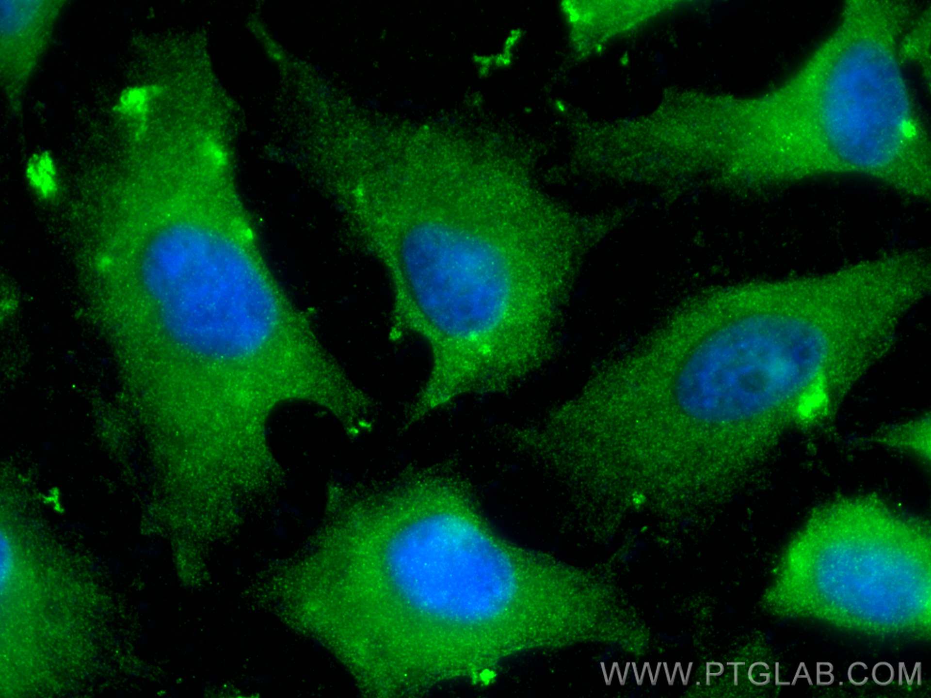 IF Staining of HeLa using 15767-1-AP