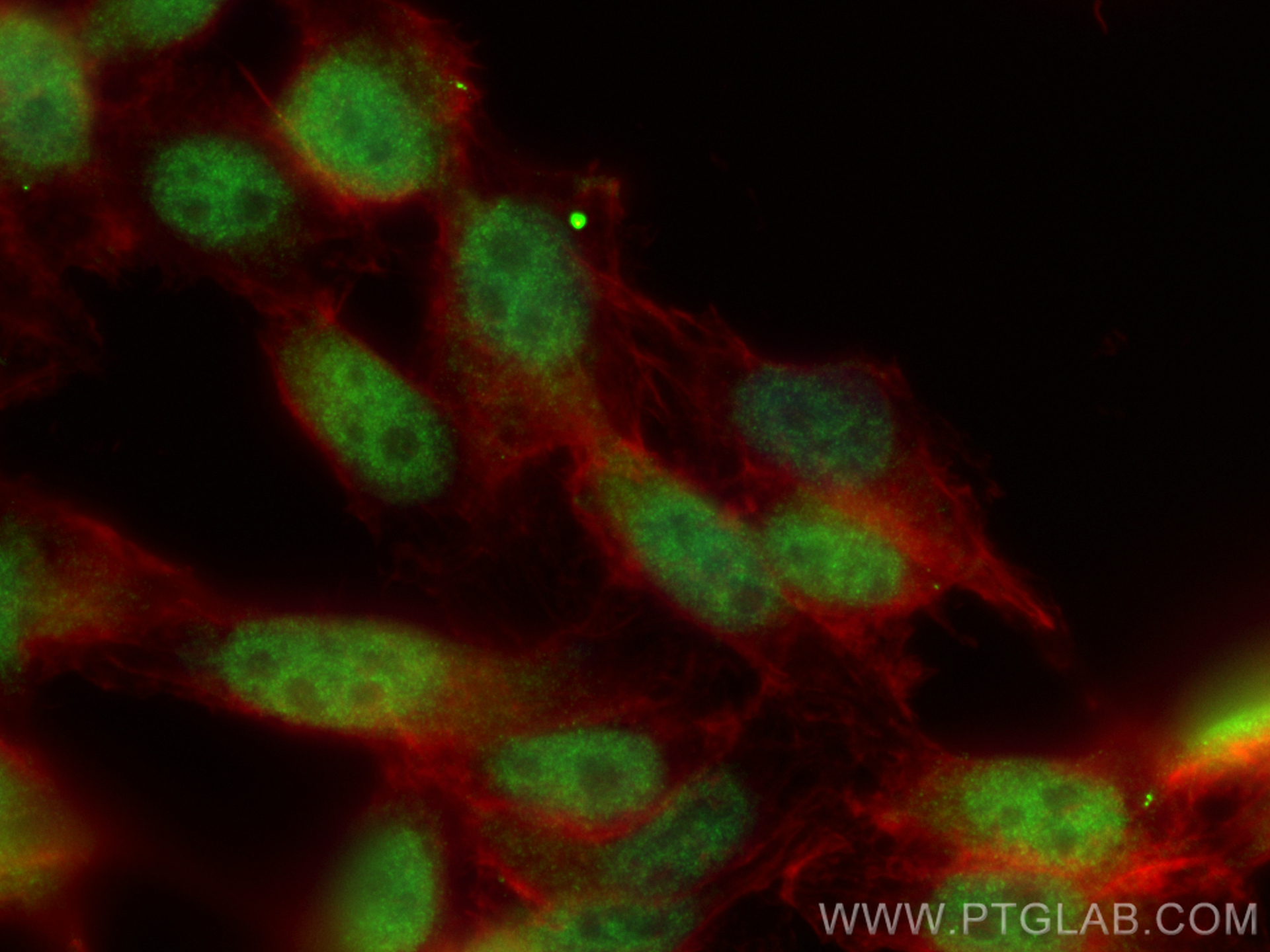 IF Staining of PC-3 using 13906-1-AP