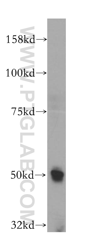 WB analysis of SH-SY5Y using 13658-1-AP