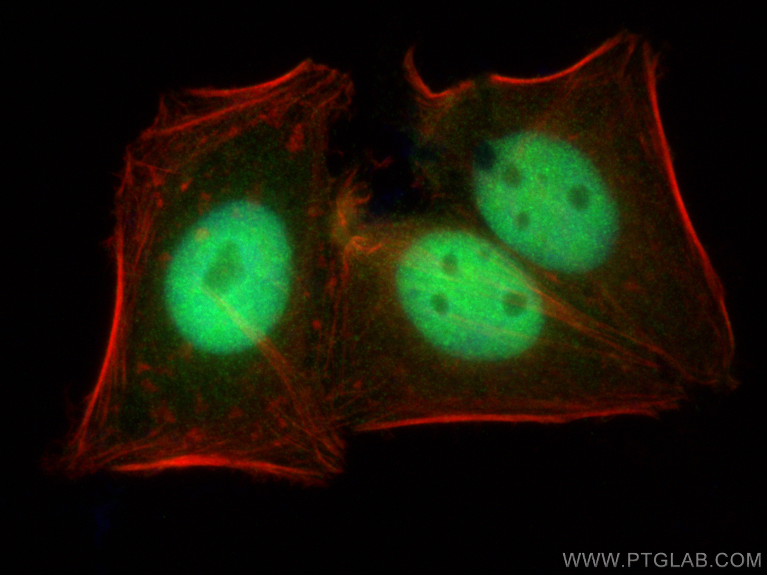 IF Staining of HepG2 using 24050-1-AP