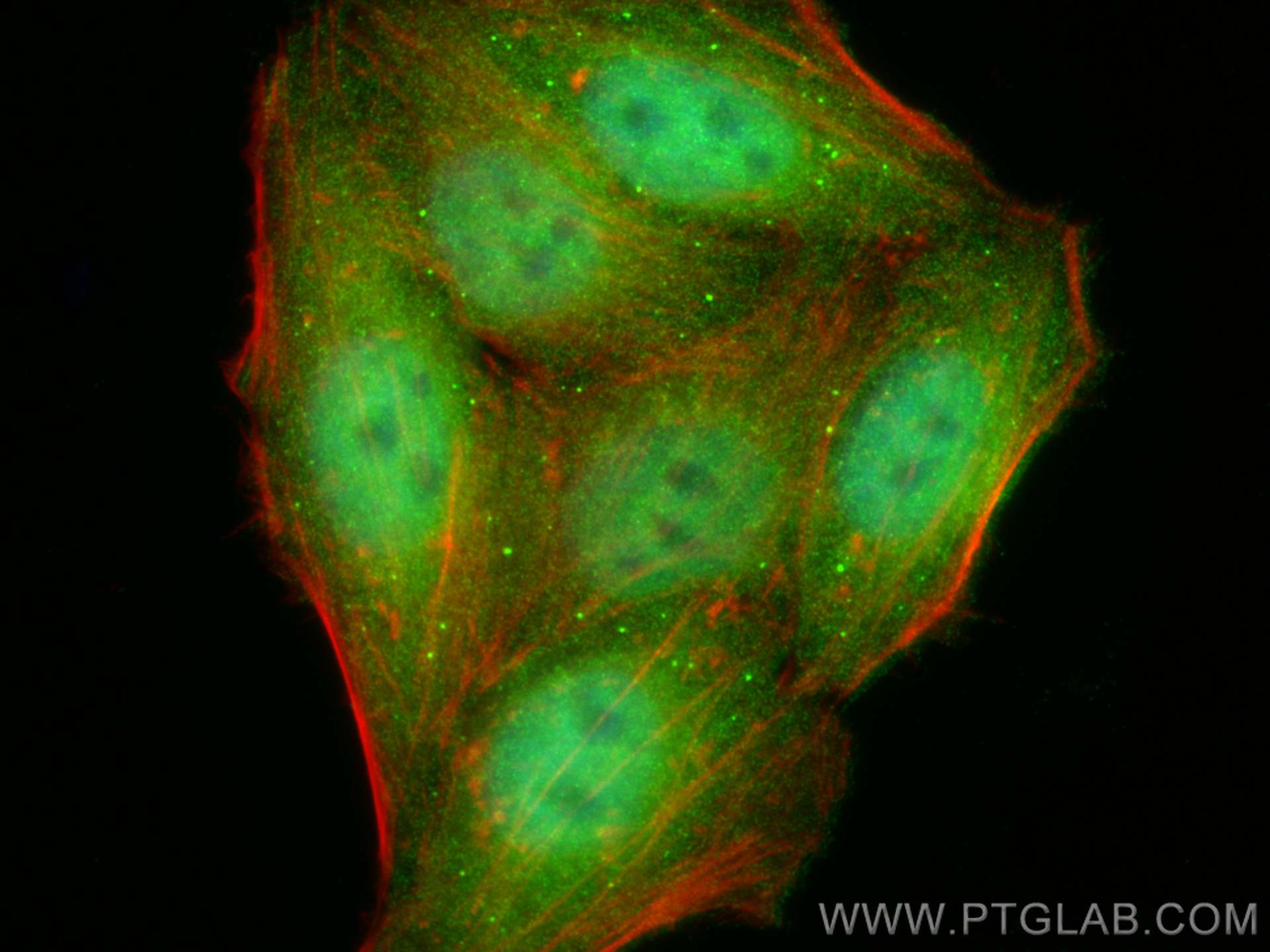 IF Staining of HepG2 using 21854-1-AP