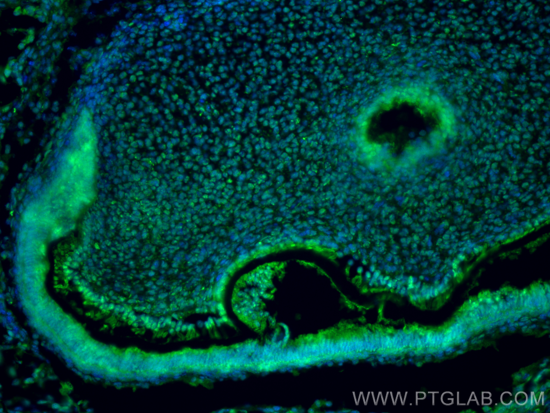 IF Staining of Customer Sample using 10975-2-AP