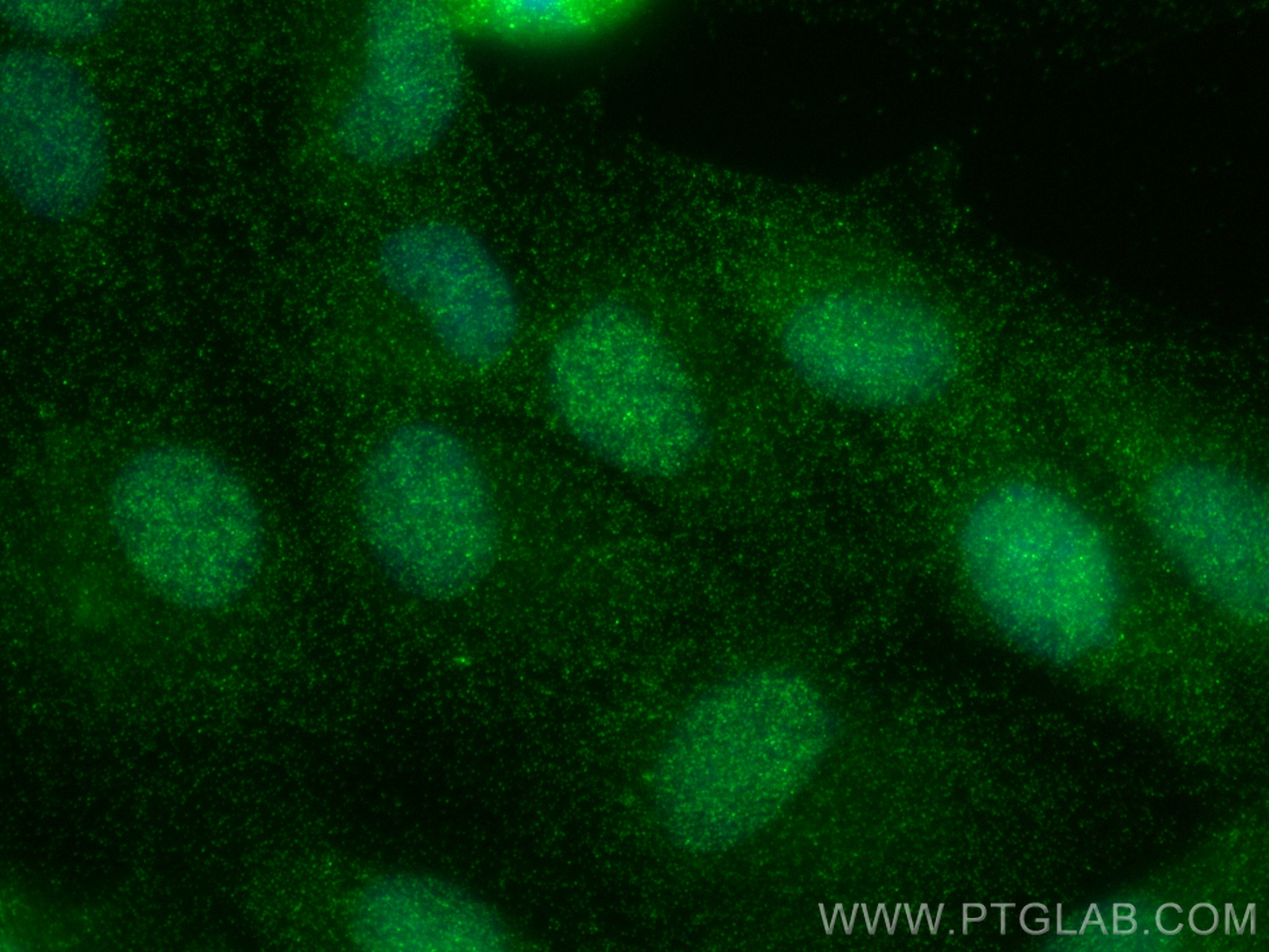 IF Staining of ROS1728 using 55405-1-AP