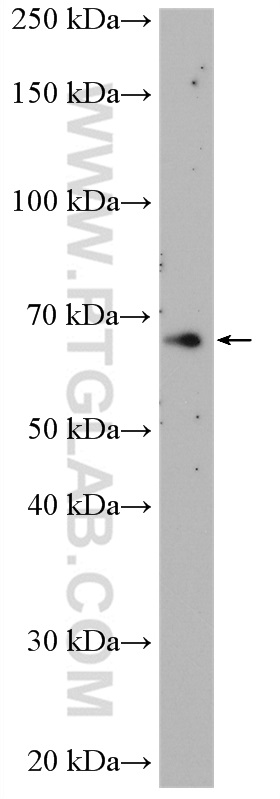 WB analysis of mouse spleen using 55405-1-AP