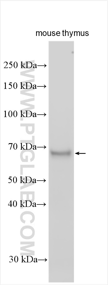 WB analysis using 55405-1-AP