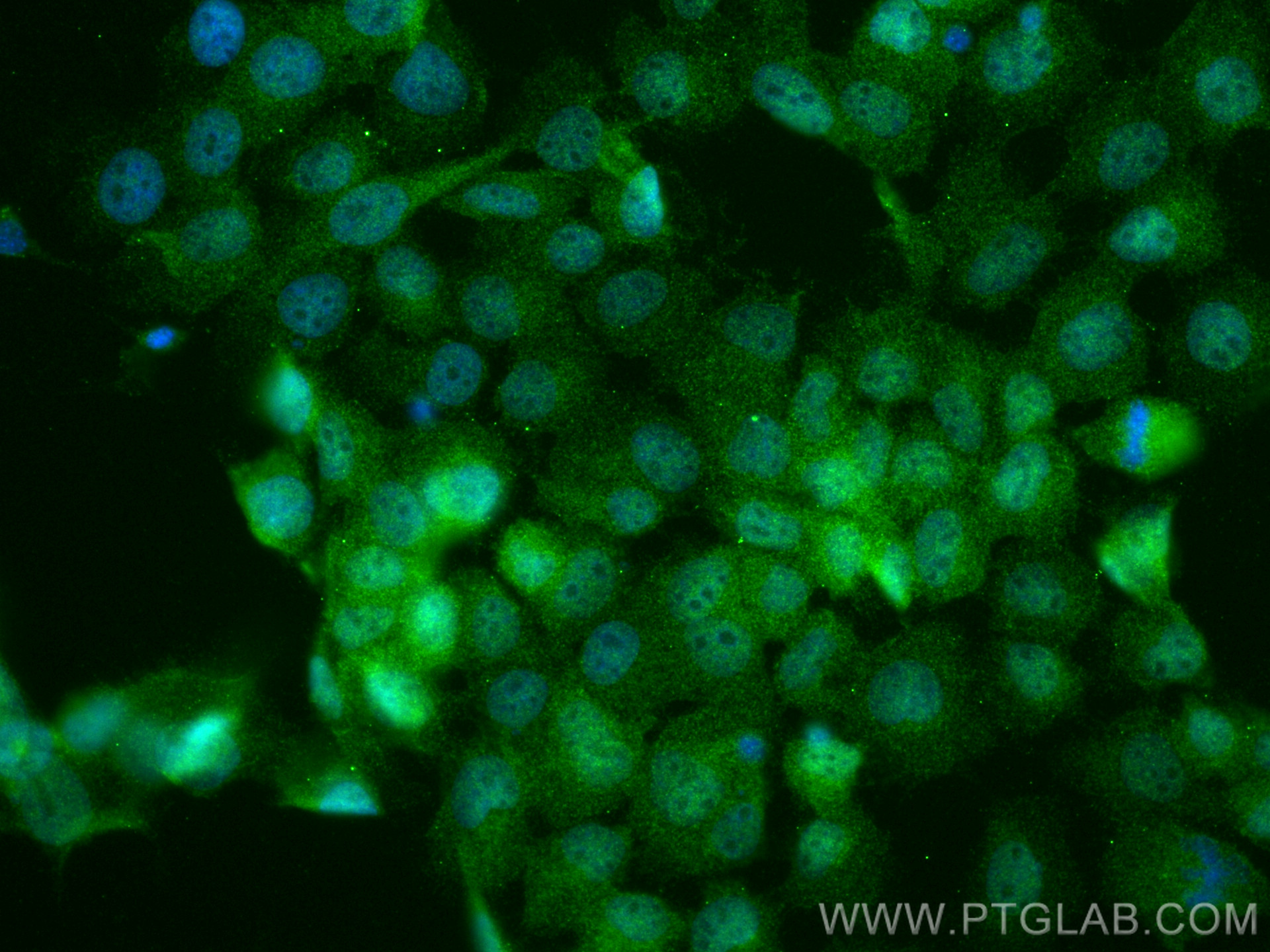 IF Staining of A431 using 14588-1-AP