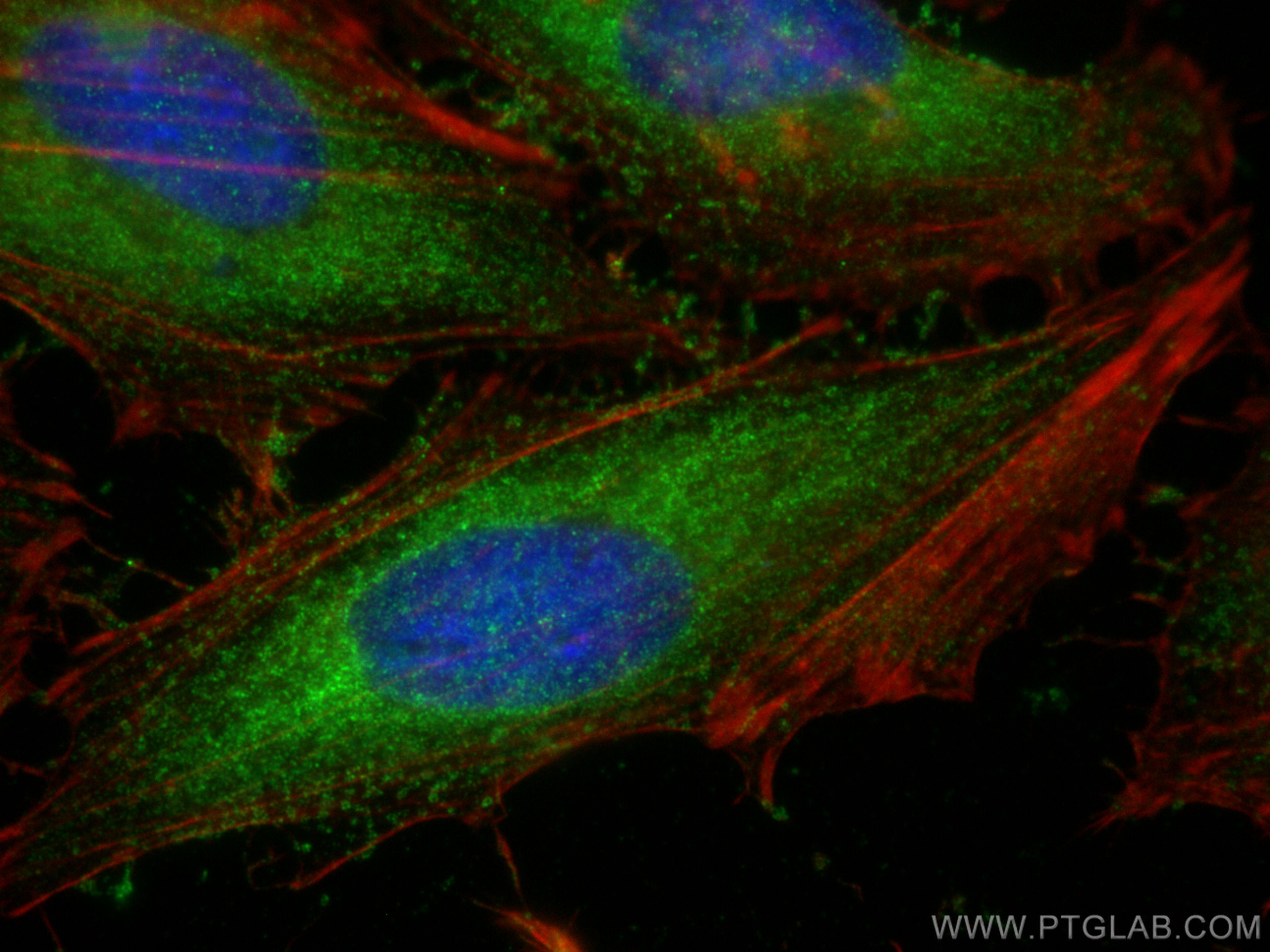 IF Staining of HeLa using 10724-1-AP