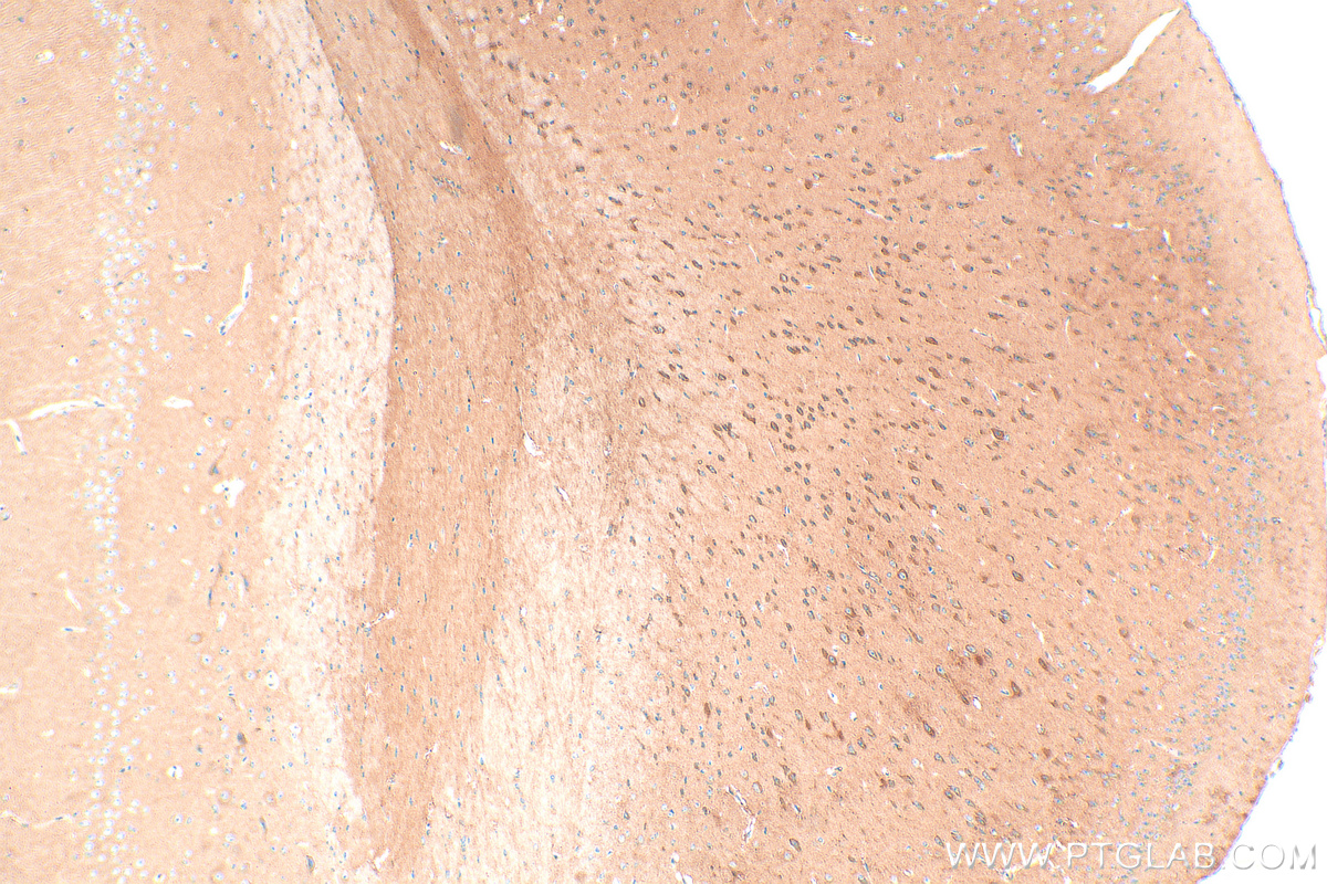 IHC staining of mouse brain using 21608-1-AP