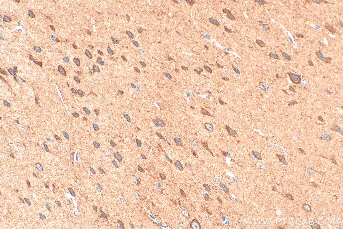 IHC staining of mouse brain using 21608-1-AP