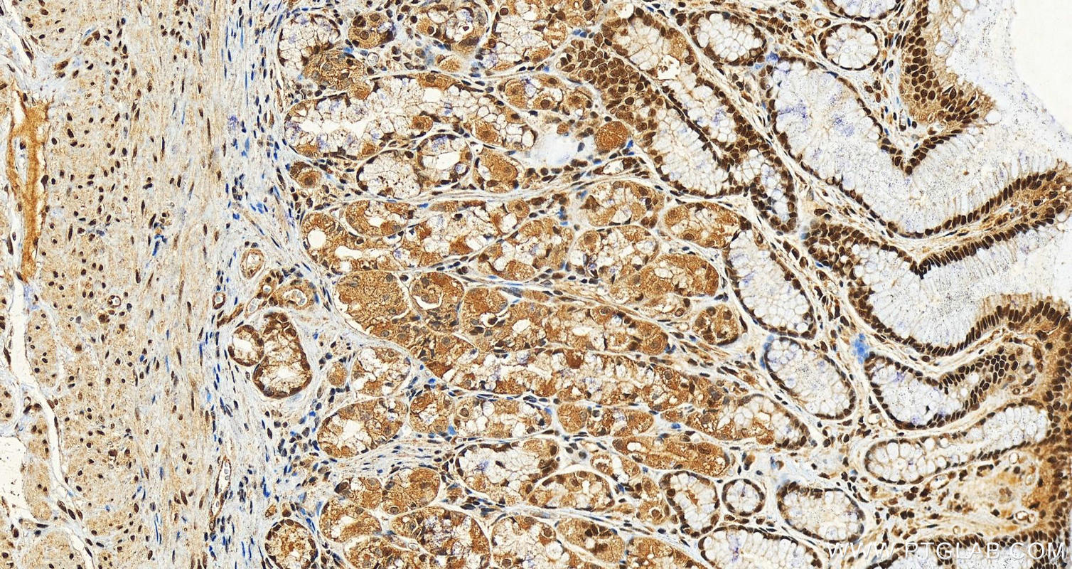 IHC staining of human stomach using 12482-1-AP