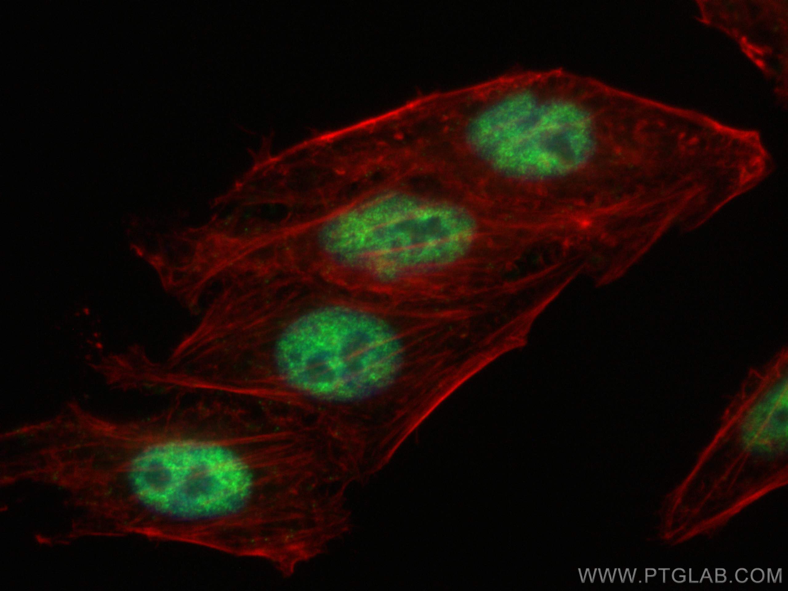 IF Staining of HepG2 using 66832-1-Ig