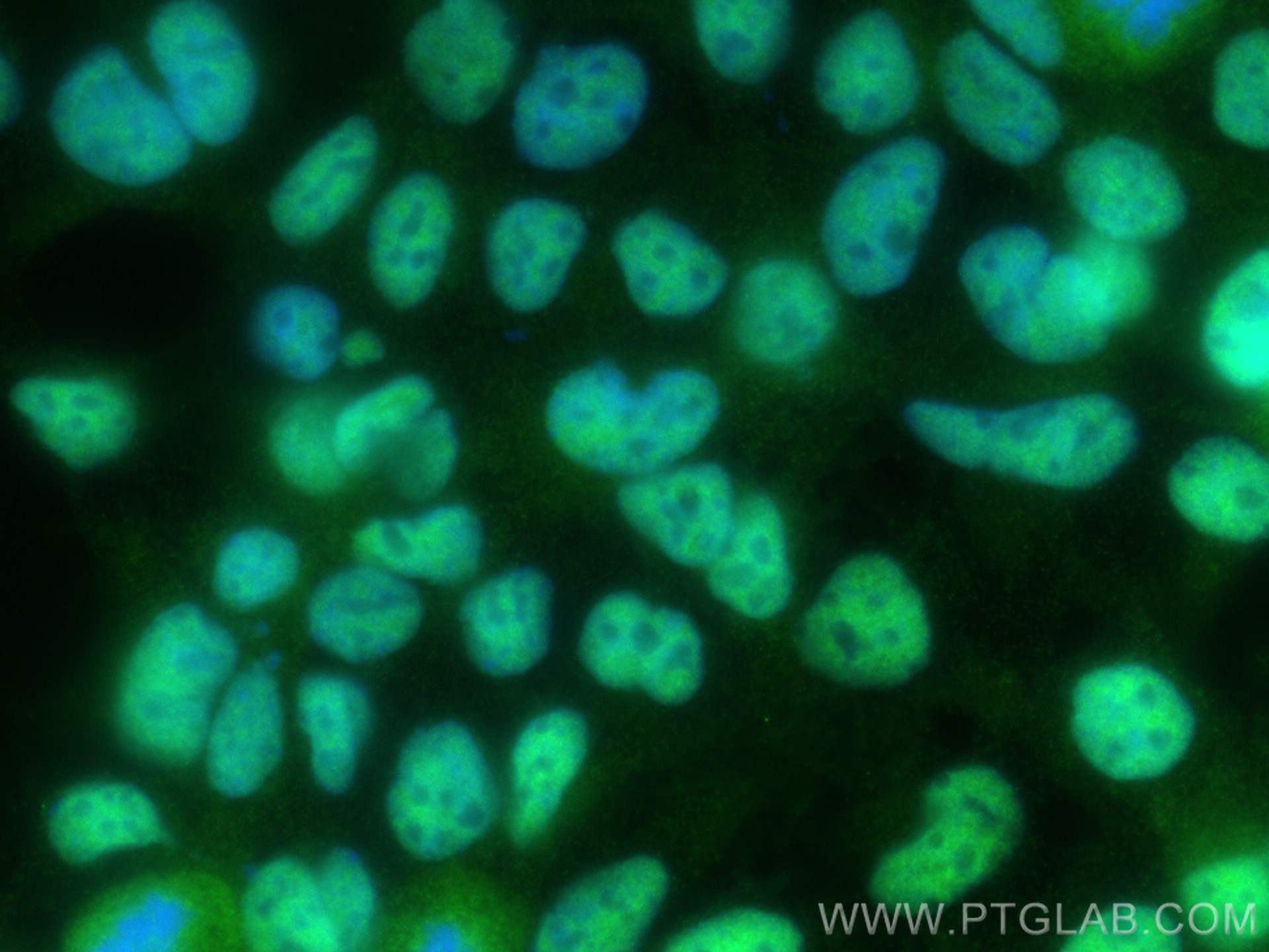 IF Staining of HEK-293 using 21542-1-AP