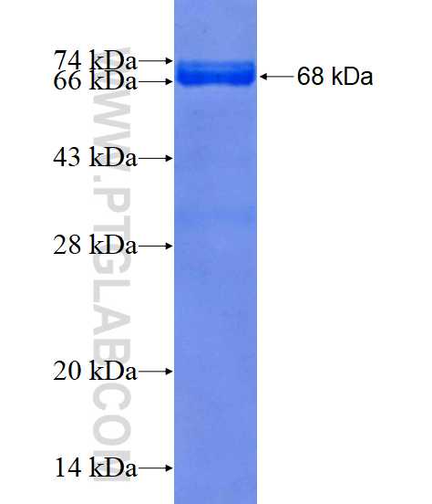 GABPA fusion protein Ag16191 SDS-PAGE