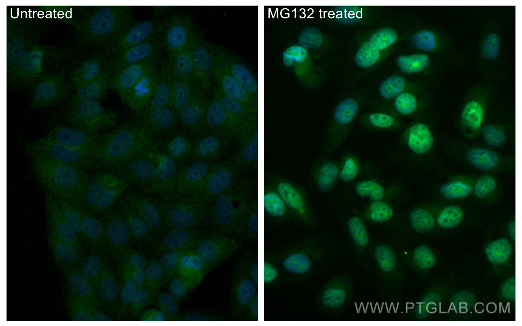 IF Staining of HepG2 using CL488-80593