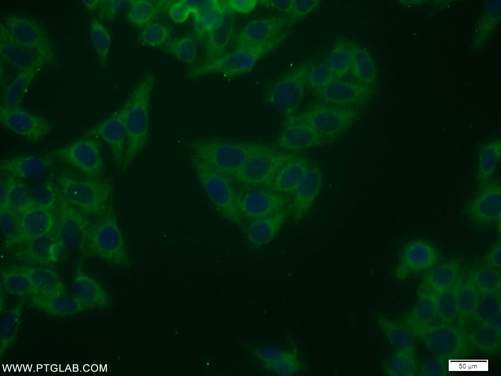 NRG1, isoform SMDF