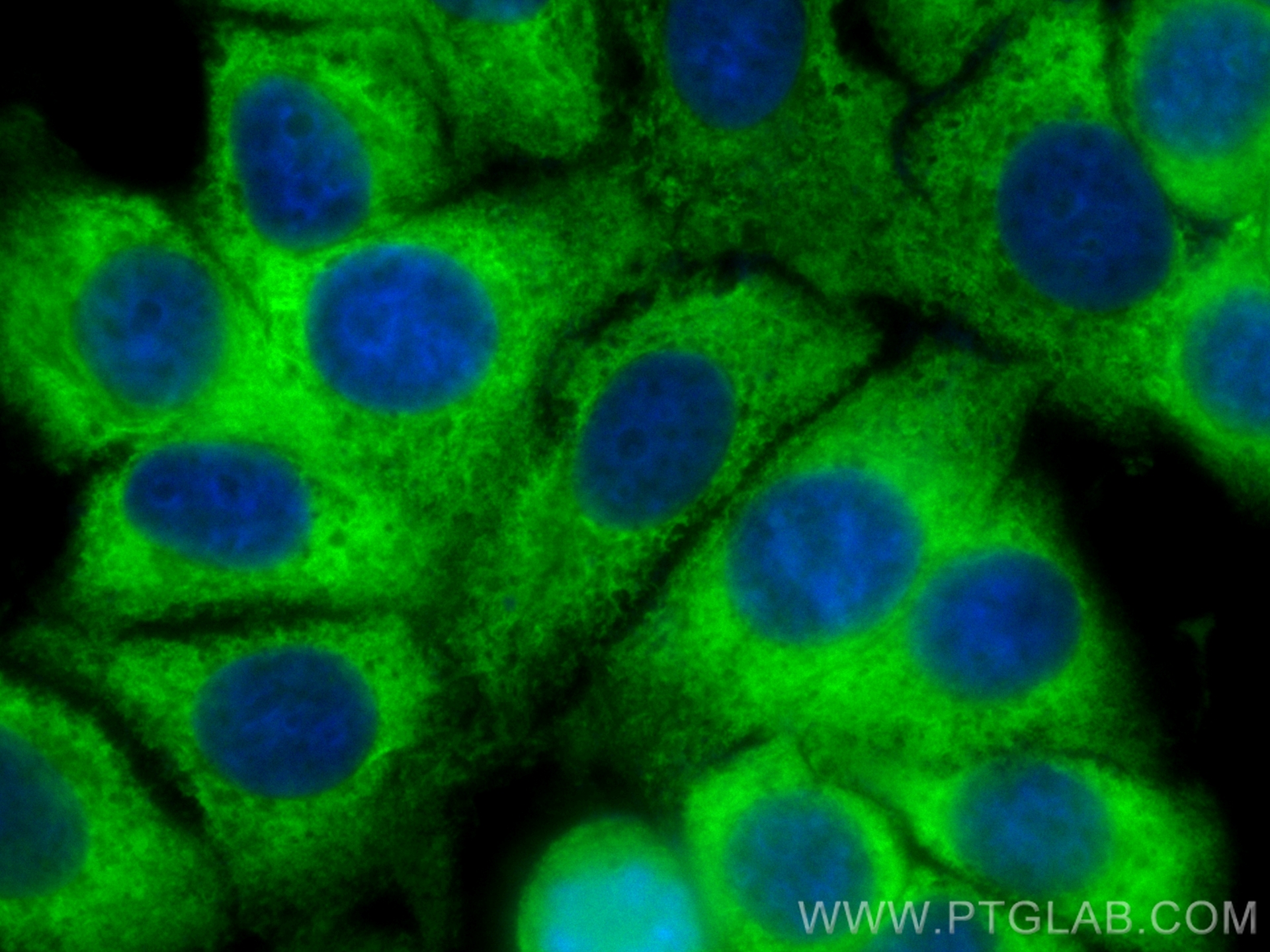 IF Staining of MCF-7 using CL488-83251-2